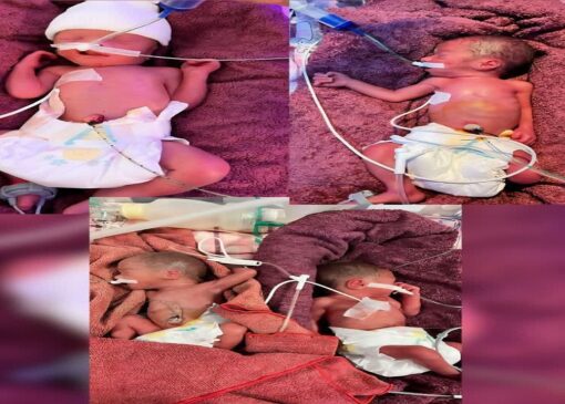 تولد چهار قلو‌ها در بیمارستان باقرالعلوم اهر