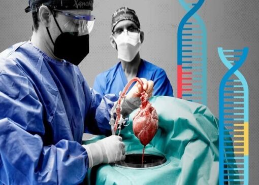 کمبود عضو؛ بزرگ‌ترین چالش پیوند در ایران/ فارس هم‌سطح کشورهای پیشرو در اهدای عضو