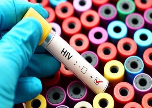 ادامه پویش «من هم تست HIV می‌دهم» در کشور تا ۲۰ آذرماه