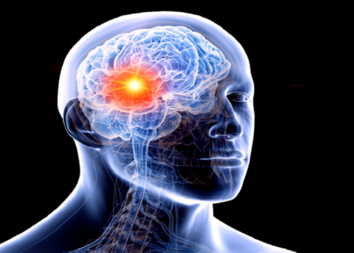 رویکردی جدید برای درمان یکی از خطرناک‌ترین تومور‌های مغزی