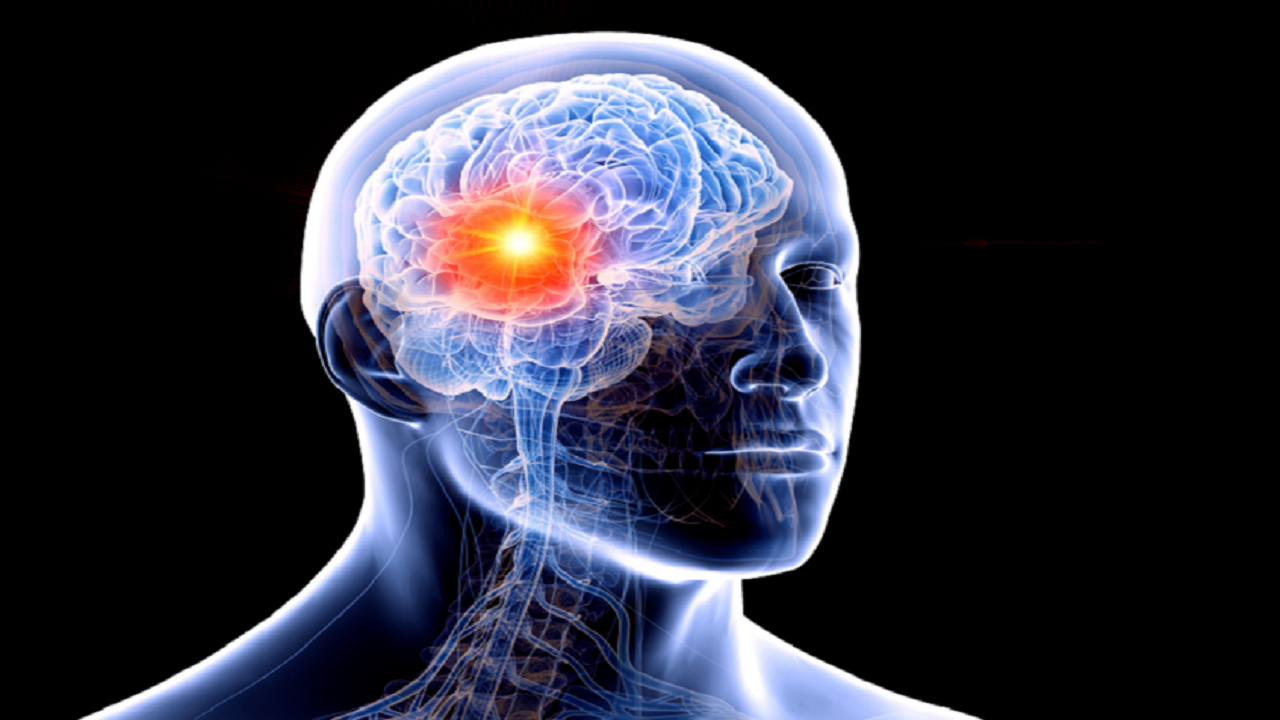 رویکردی جدید برای درمان یکی از خطرناک‌ترین تومور‌های مغزی