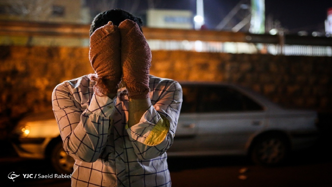 فوت ۵ تا ۱۰ درصد از بیماران بستری ناشی از سوختگی/ بروز سوختگی برای ۳۰۰ هزار نفر در سال