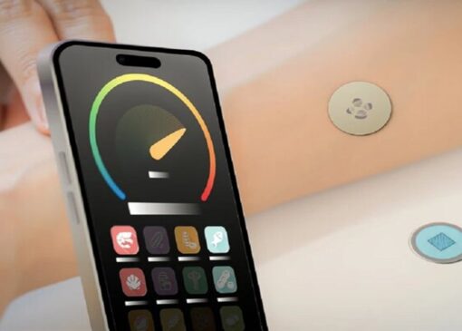 برچسبی کوچک که «فرشته نجات» افراد آلرژیک می‌شود