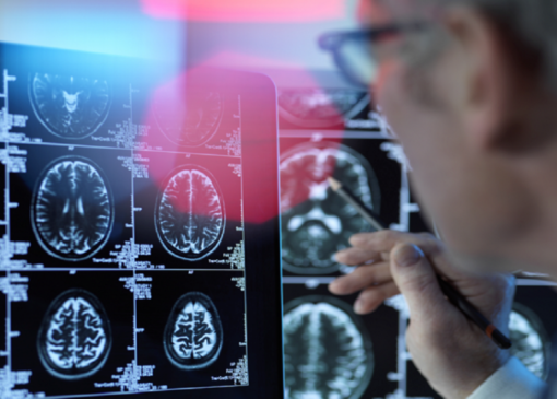 علامت‌های هشدار دهنده در میانسالی برای زوال عقل در مراحل بعدی 