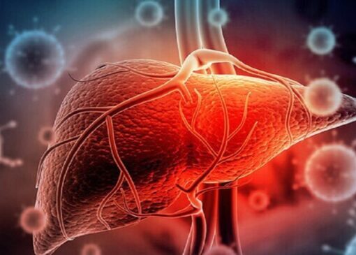 بیماریِ «بی‌صدا» که کبدتان را می‌خورد؛ علائمی که باید جدی بگیرید