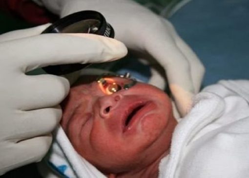 پیشگیری از اختلالات بینایی با غربالگری چشم نوزادان نارس + فیلم