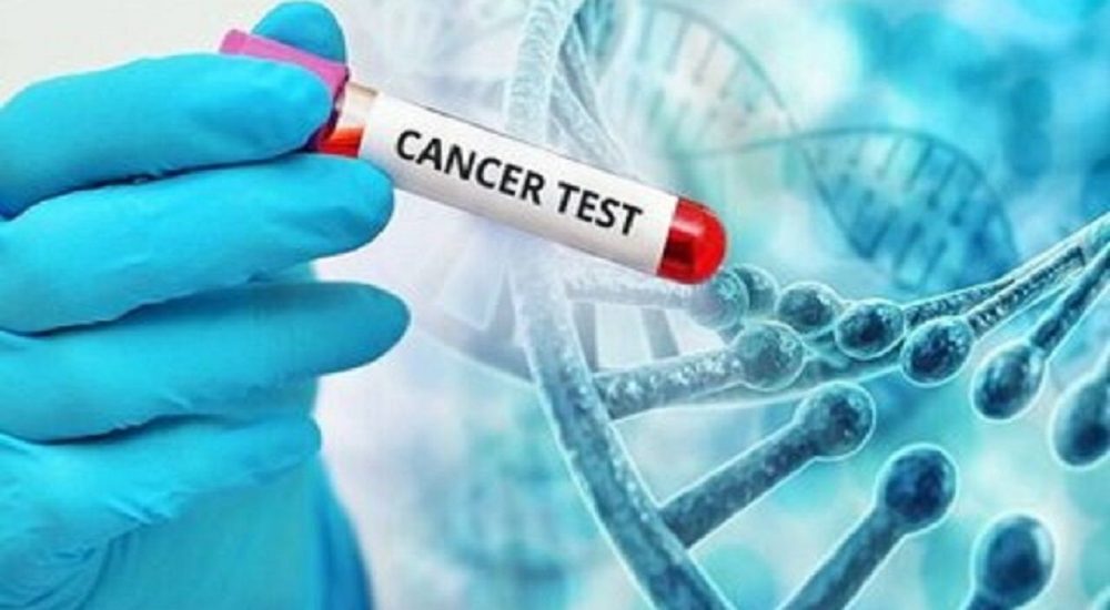 غربالگری رایگان سرطان‌های شایع در مراکز بهداشتی قم